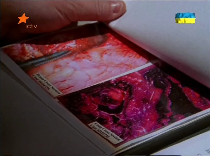 Поширення вірусу кадр 2